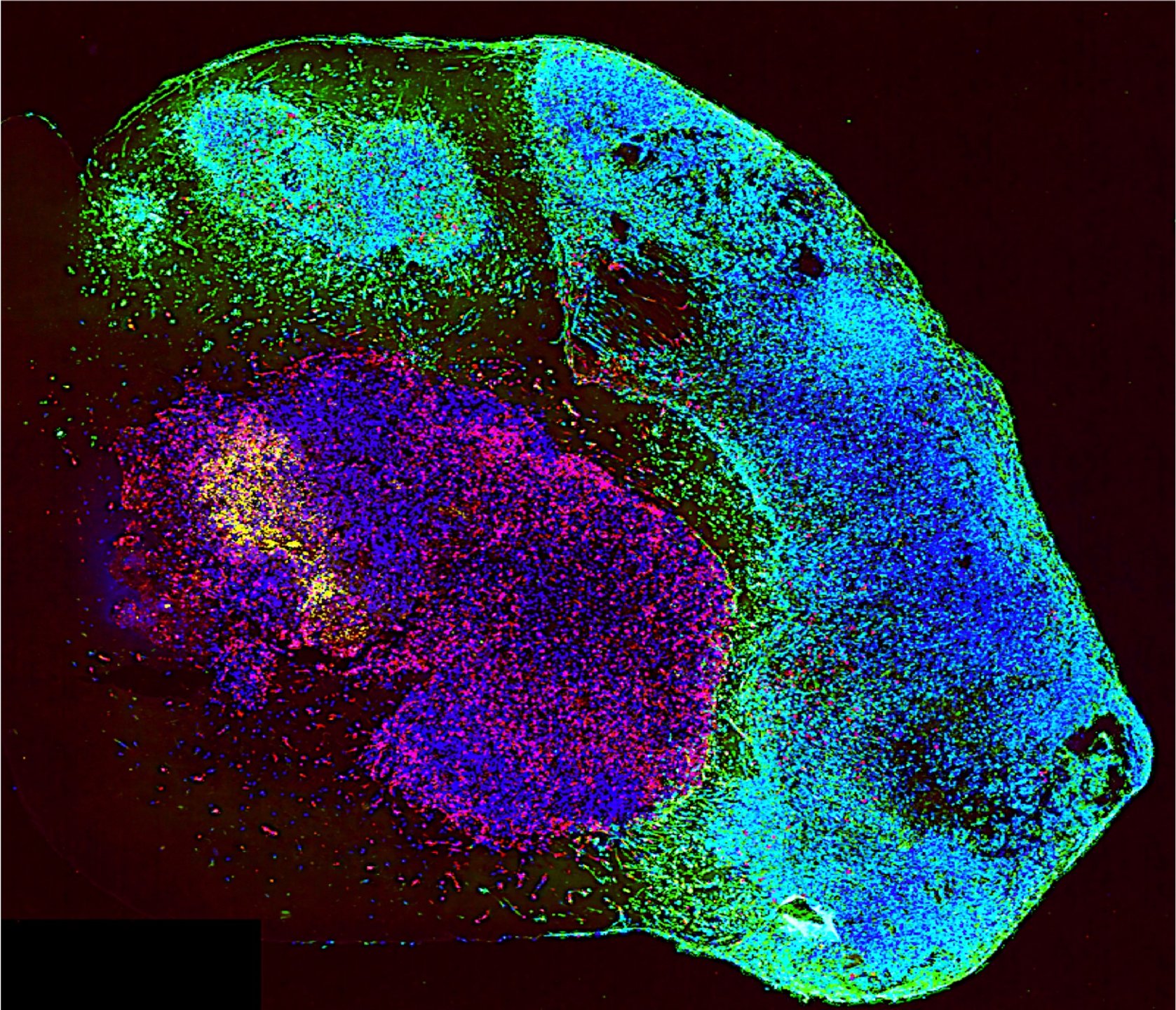 Patient Avatar Histology